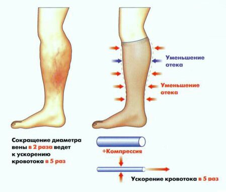 Отек в ногах: причины и лечение: статьи клиники Оксфорд Медикал Киев